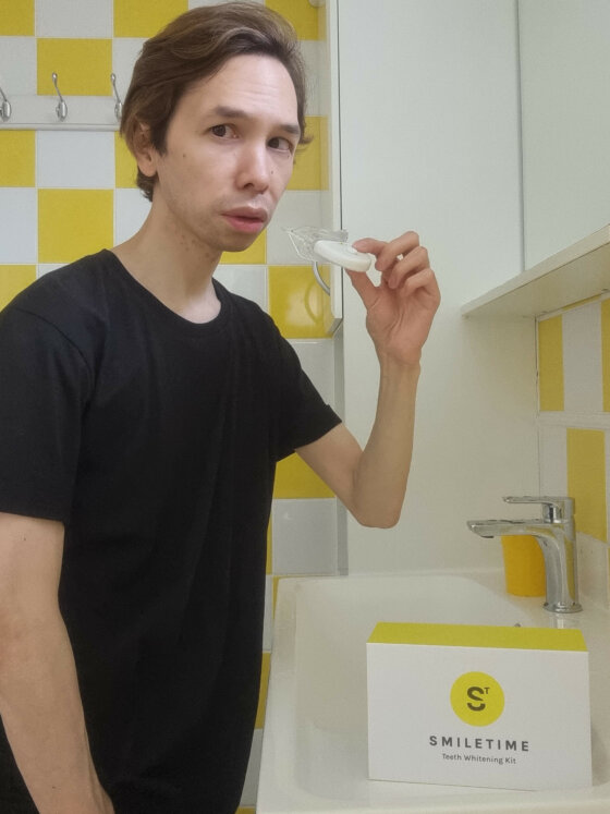 TOP TIPS TO IMPROVE YOUR SMILE APART FROM TEETH WHITENING KITS